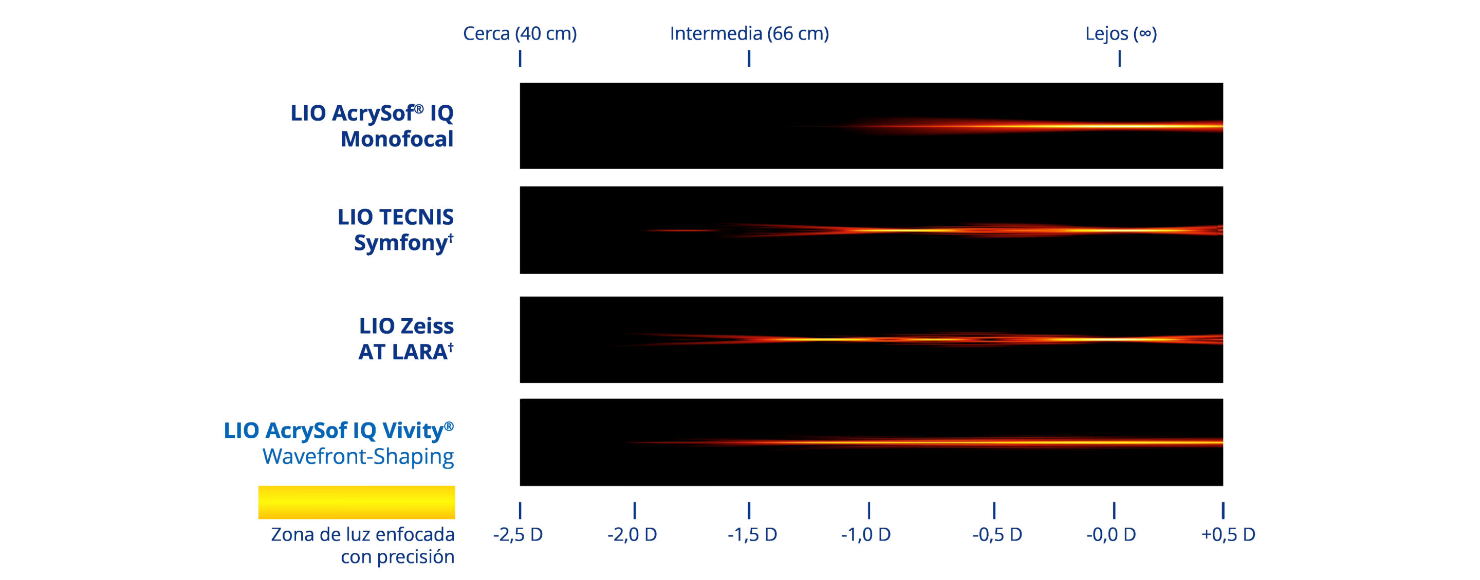 Gráfico que ilustra el rango de visión con cuatro LIOs diferentes. La LIO AcrySof® IQ monofocal proporciona visión de lejos. La LIO Symfony proporciona visión de lejos, intermedia y de cerca. La LIO AT LARA proporciona visión de lejos y dos puntos focales intermedios. La LIO AcrySof IQ Vivity® proporciona un rango continuo de visión desde lejos hasta la distancia de cerca funcional.
