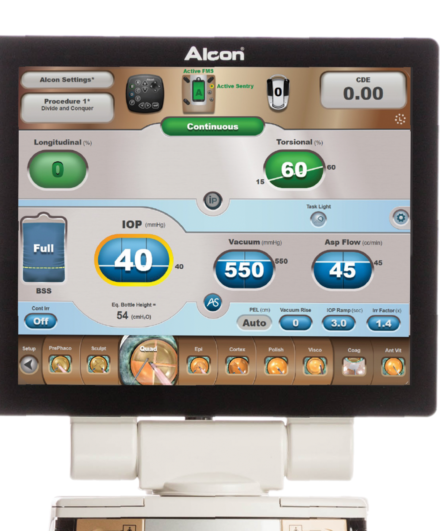 Een afbeelding van de grafische gebruikersinterface van het CENTURION Vision System.  