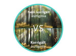 Erdő elmosódott képe nem korrigált asztigmiával, összehasonlítva az éles és fókuszált képpel korrigált asztigmia esetén